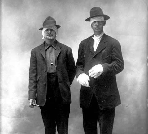 The Big Burn Collection <br /><br />